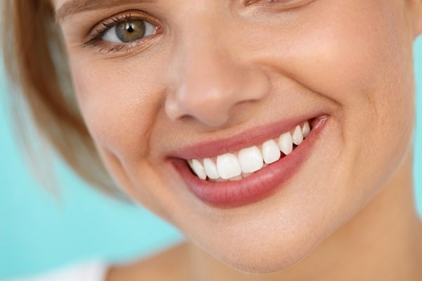 take-home-teeth-whitening